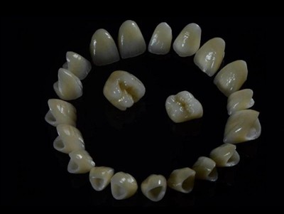 Coroas de zircônia para laboratório dentário: qualidade, processo e o que pro...