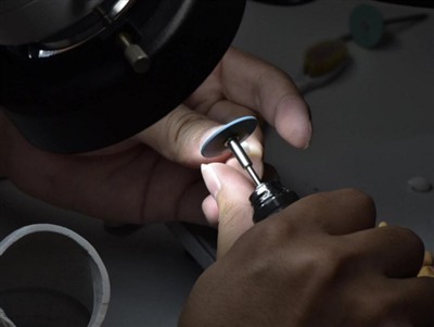 Quanto tempo duram as coroas PFM? Vida média, fatores e dicas de cuidados